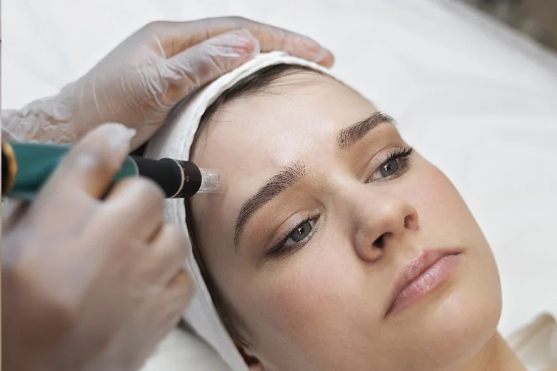 Gesichtsbehandlung Microneedling waiblingen